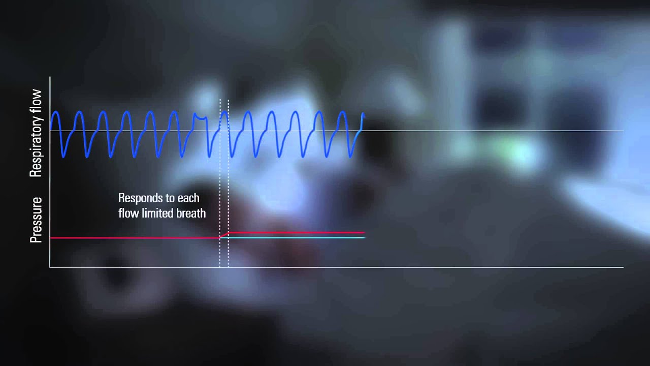 airsense-10-autoset-for-her-for-