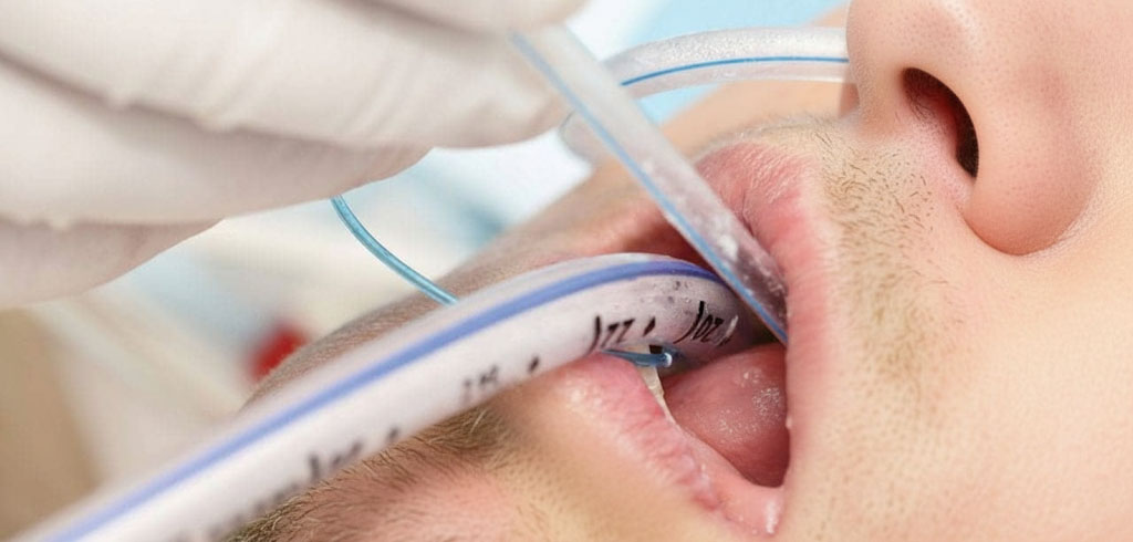 Aspirația respiratorie secreții: Ghid practic pentru aparținători și îngrijitori