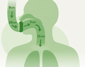 product_feature_4005